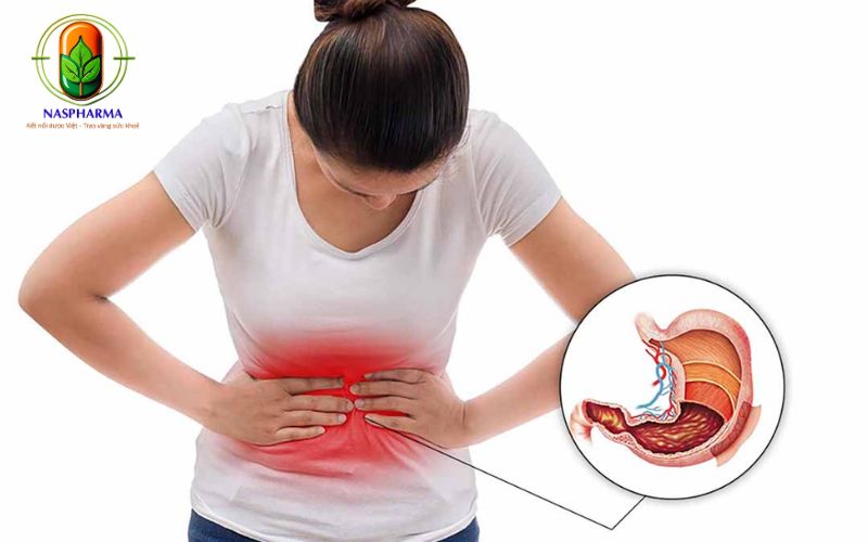 Đau Dạ Dày Là Gì?